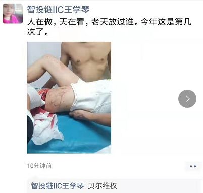 BRC贝尔链崩盘，领导人被砍场面血腥