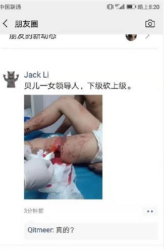贝尔链维权者砍断大腿，崩盘跑路已成定局，这曾经的百倍币下场甚是凄惨····
