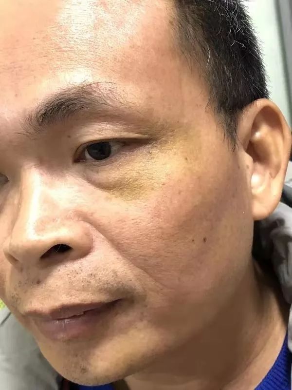 起底黄金链：走投无路企业家遇上俞凌雄的敛财之路